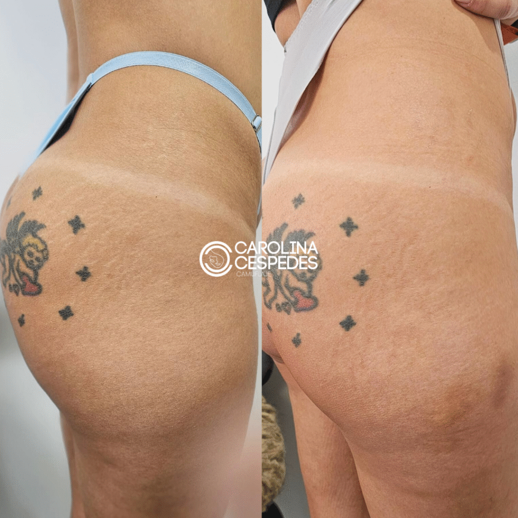 Antes y después Carolina Céspedes (10)
