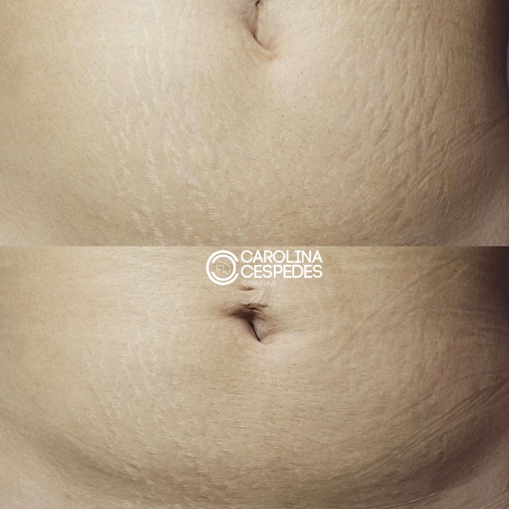 Antes y después Carolina Céspedes (20)