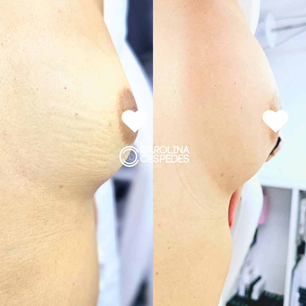 Antes y después Carolina Céspedes (6)